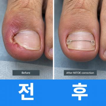 피부,미용 젊음으로 행복하게 - 항노화클리닉S