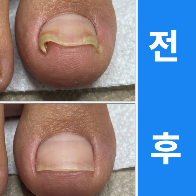 청담15년 경력의 서울대병원 출신 전문의