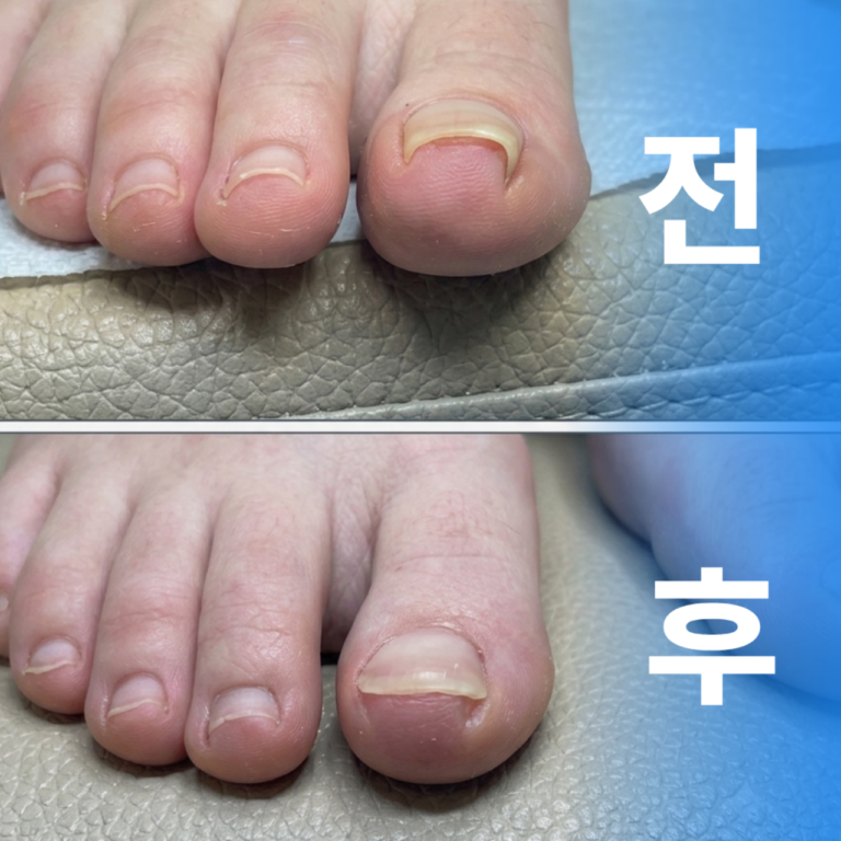통증전문의의 정확한 진료로 행복하게 -통증클리닉